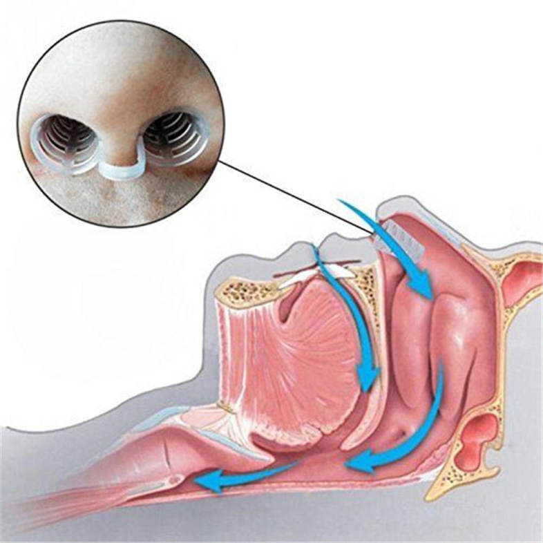Set of 2 Premium Anti-Snoring Nose Vents Soft Silicon Stop Snoring Device Night