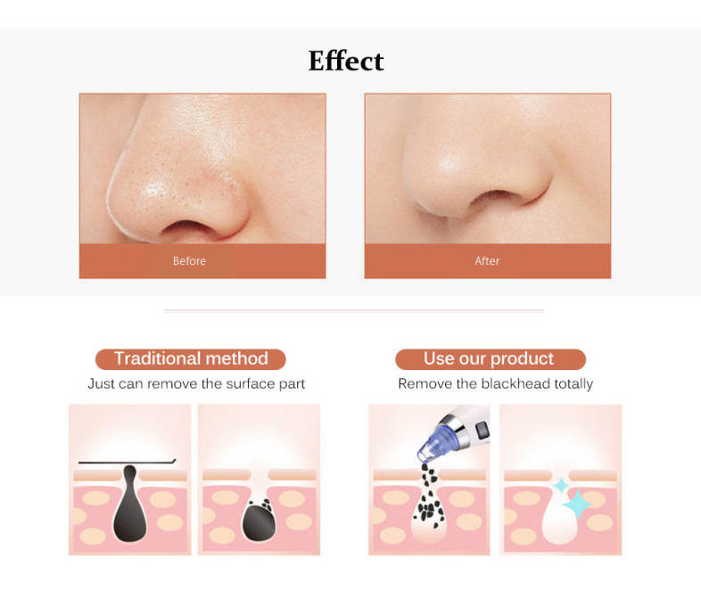 Facial Pore Blackhead Remover Acne Cleanser Vacuum Machine with LCD Display