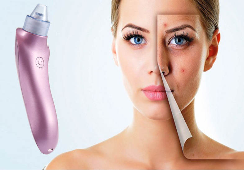 Electric Blackhead Sucking Instrument Pore Cleaner Cleaning Machine