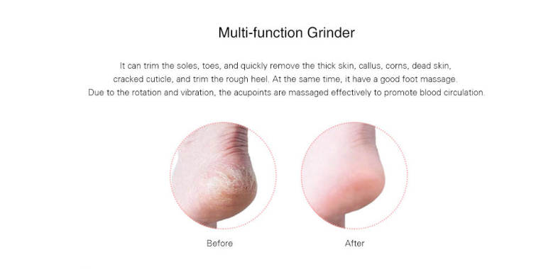 Multi-function Massage Powerful Electric Foot Grinder
