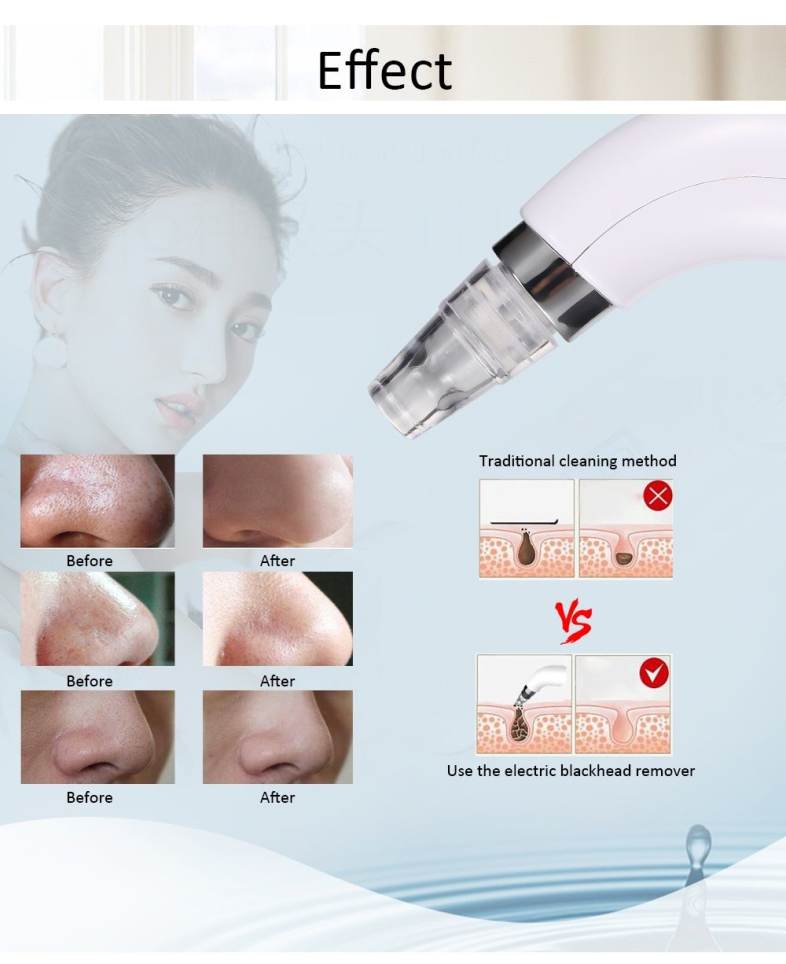 Electric Blackhead Remover Skin Beauty Suction Acne Removal Instrument