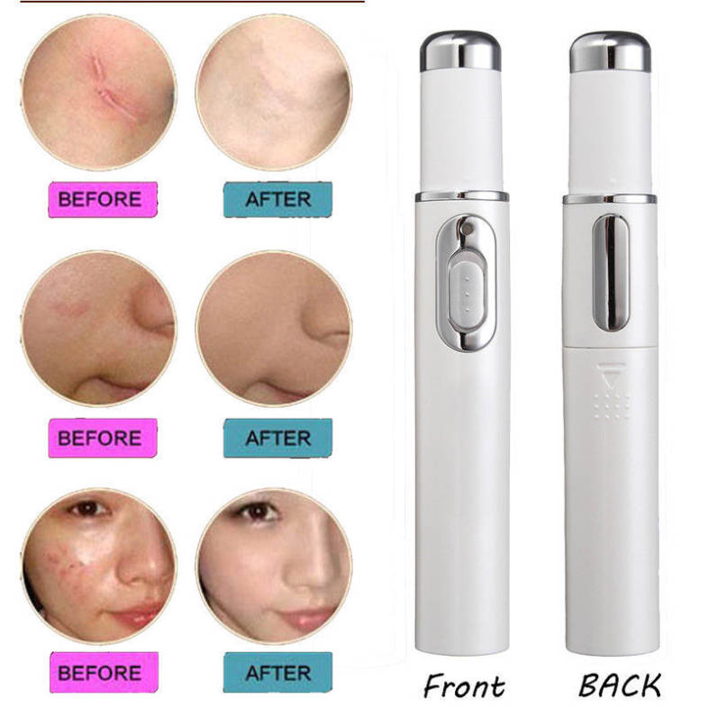Beauty Instrument Blue Light Therapy Laser Pointer Remove Acne Scars  Anti-Wrinkle Face Treatment Pen